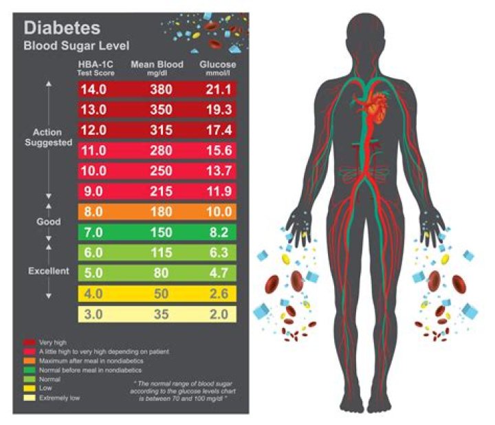 What glucose level is considered diabetic?