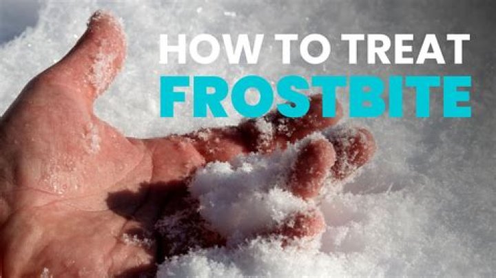 What is frostbitten food?