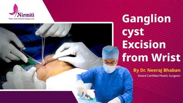 What is ganglionectomy in medical term?