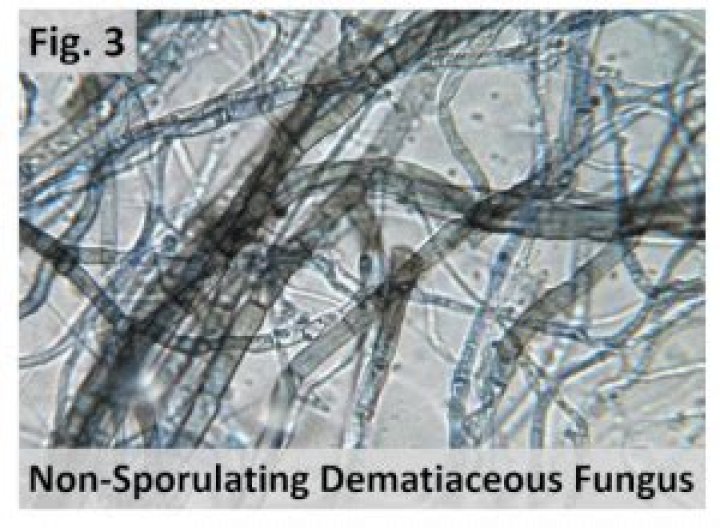 What is non sporulating fungi?