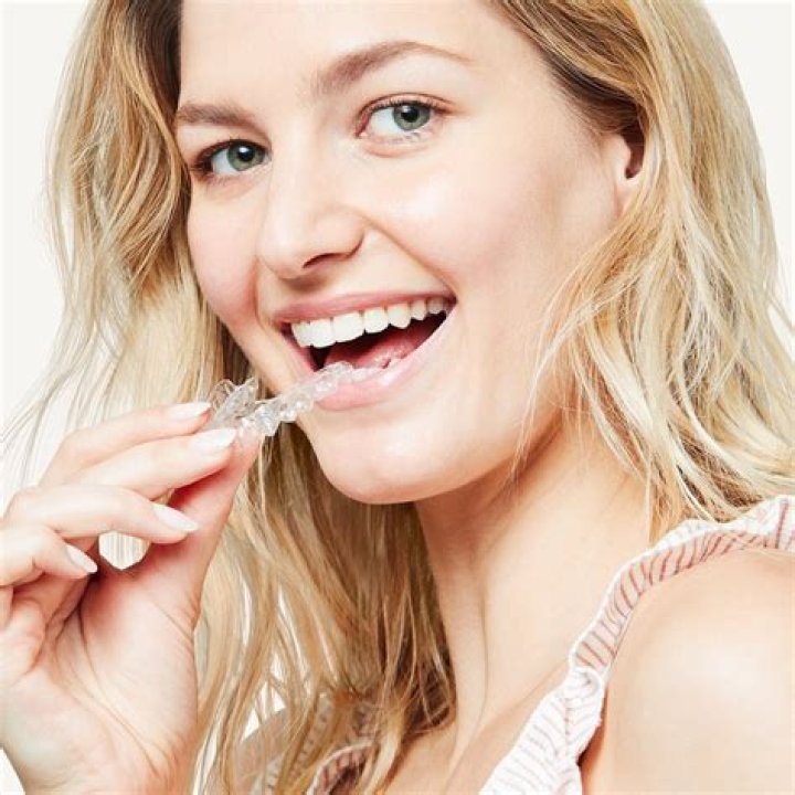 What is smile direct club?