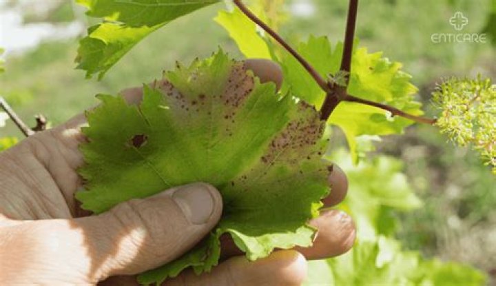 What is tenuis allergy?