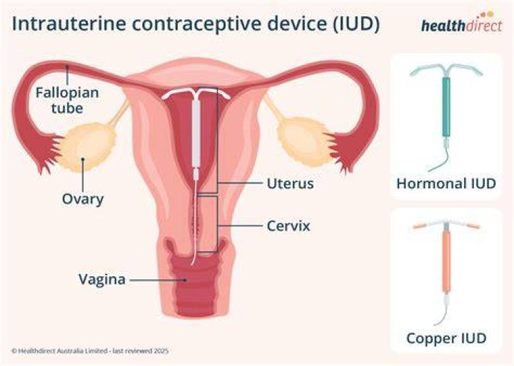 What is the meaning of intrauterine?
