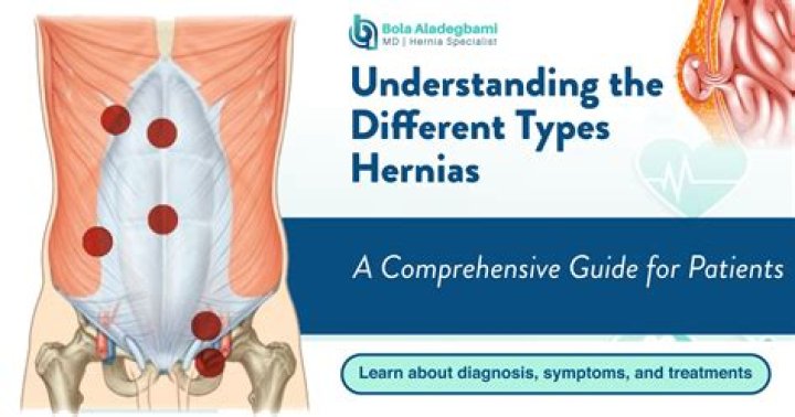 What is the most common hernia?
