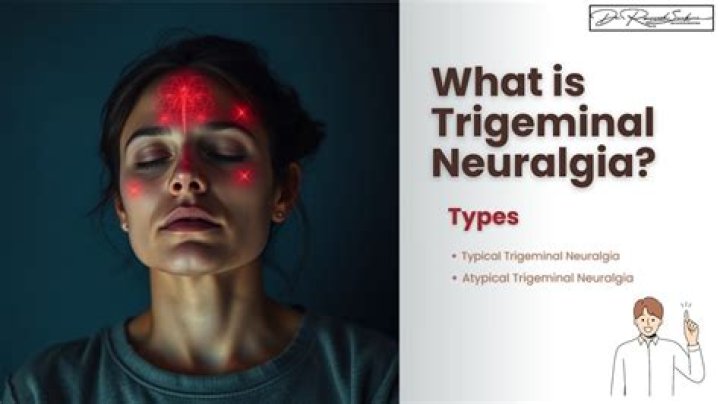 What is trigeminal neuropathy?