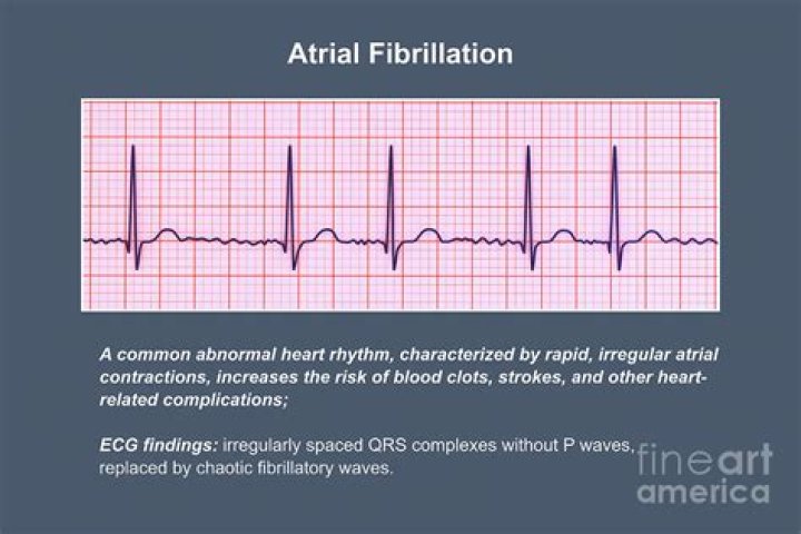 What is well controlled atrial fibrillation?