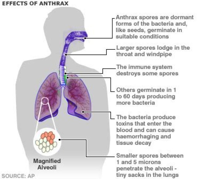 What manifestation of anthrax?