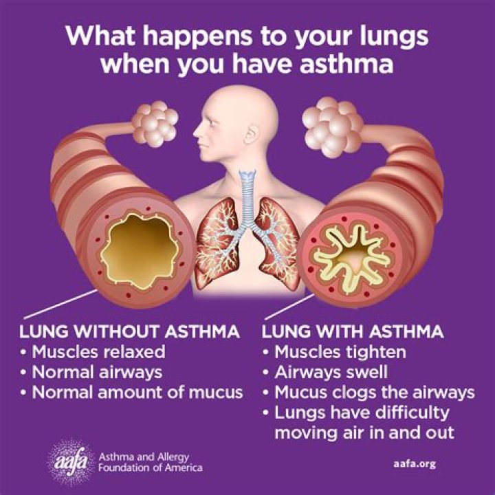 Whats an asthma cough like?