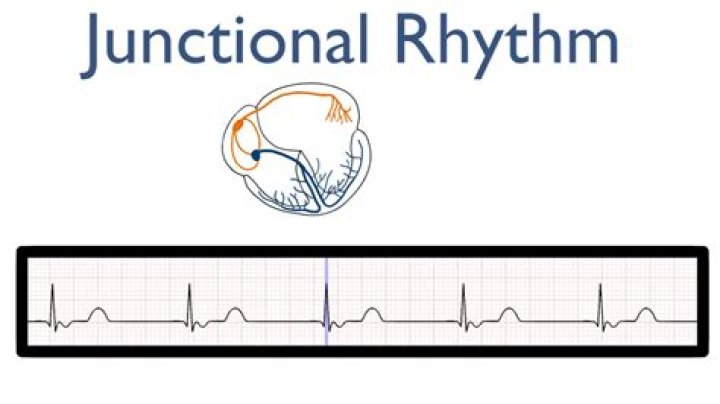 Whats an unsyncopated rhythm?