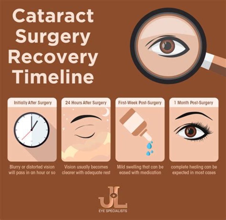 Whats the recovery time for cataract surgery?