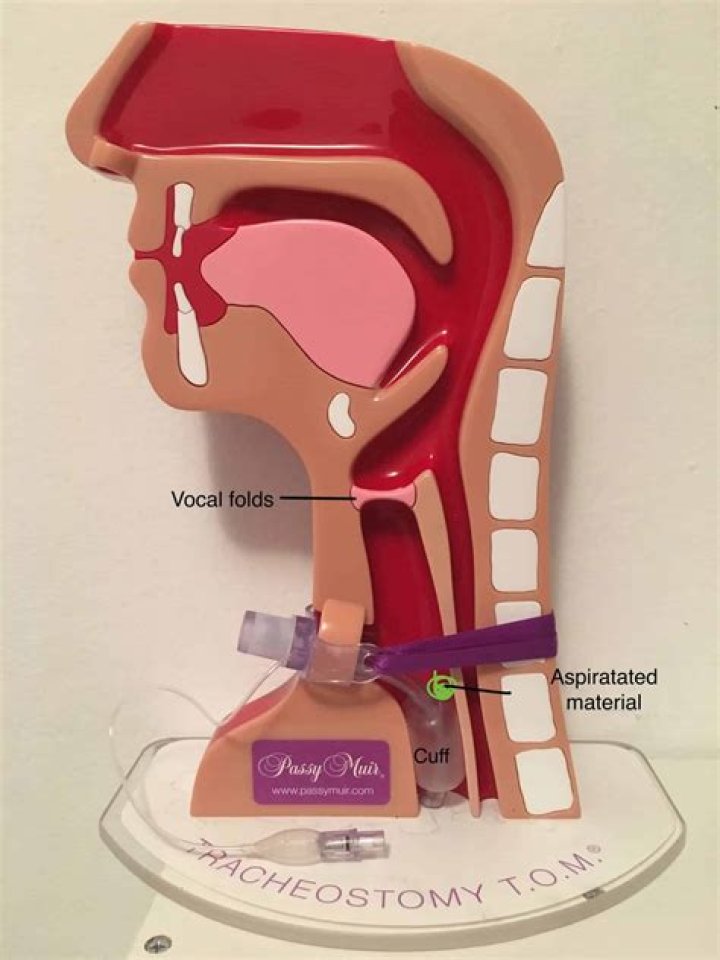 When should tracheostomy cuff be inflated deflated?