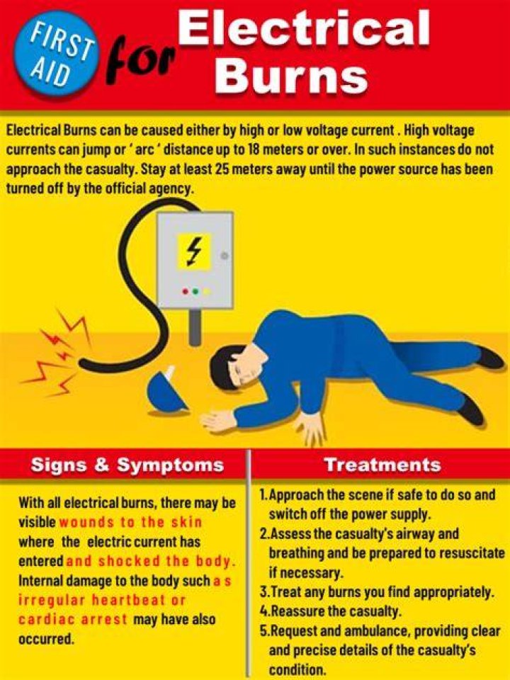 When sustaining electrical burn?