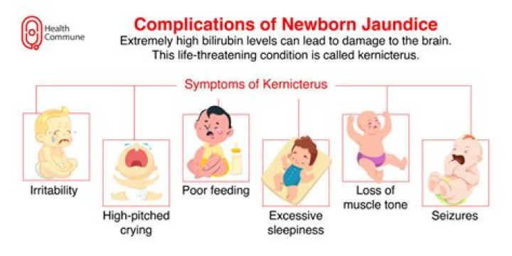 When to take a jaundiced baby to hospital?