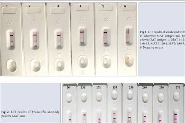 When to test for tularemia?