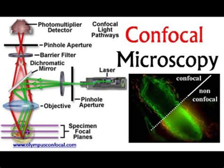 When to use confocal imaging?