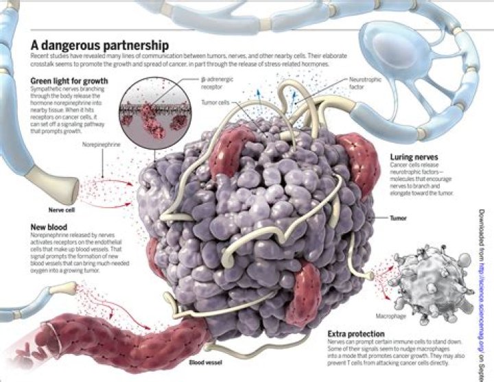 Where do brain cancer come from?