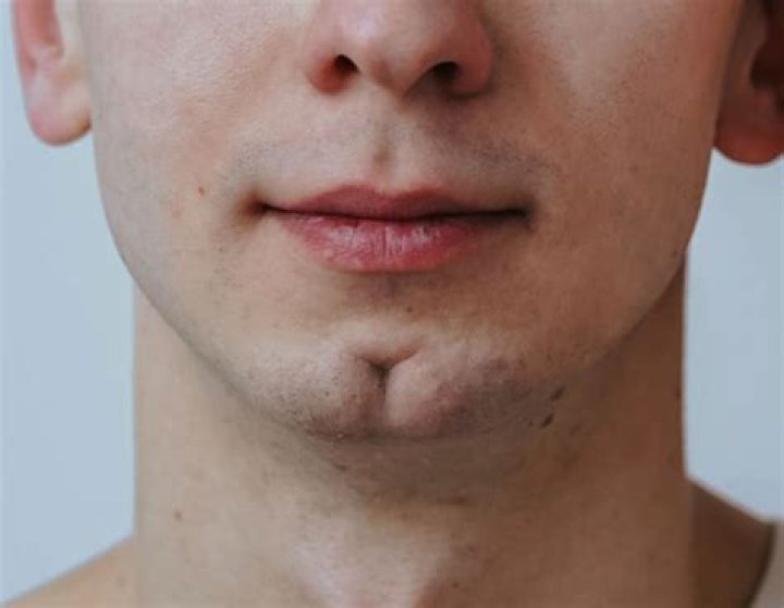 Where do dimpled chins come from?