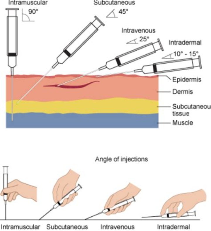 Where to give intravenous injection?