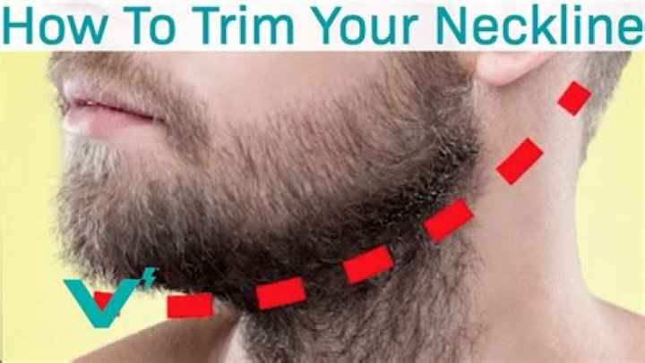 Where trim beard neck?