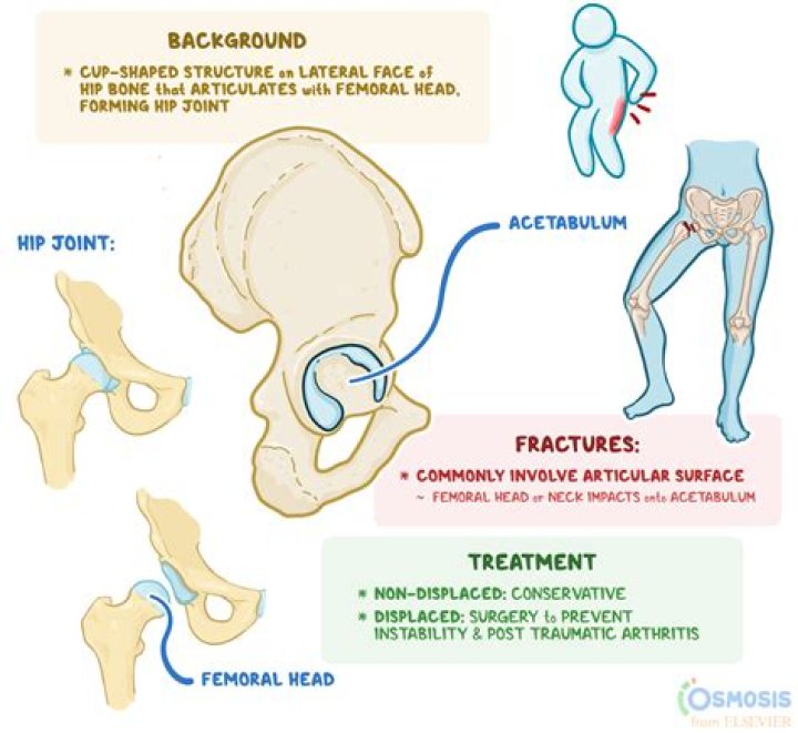 Which bone articulates in the acetabulum?