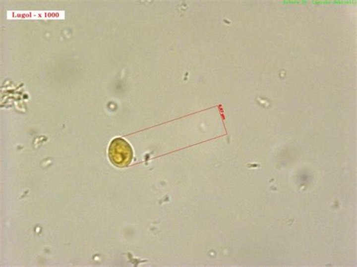 Which cyst is characteristically pear shaped?