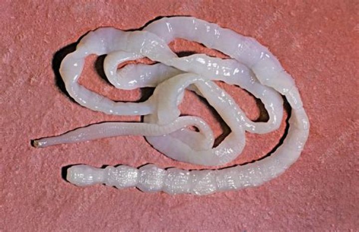 Which is the smallest tapeworm?