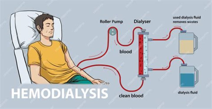 Which kind of membrane is used in haemodialysis?