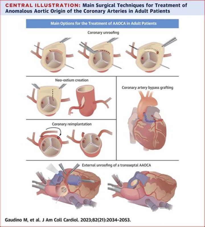 Who first in the world provided aortocoronary shunting?