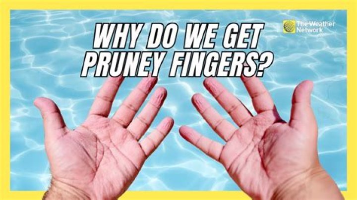Why do fingers get pruney?