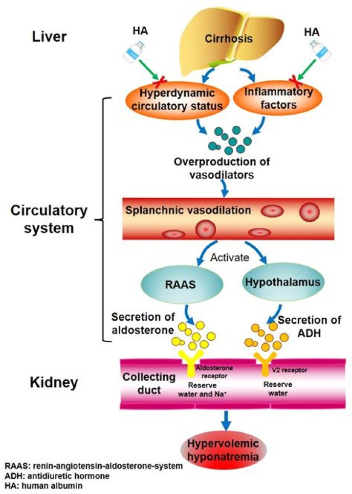 Why hypoalbuminemia in liver cirrhosis?