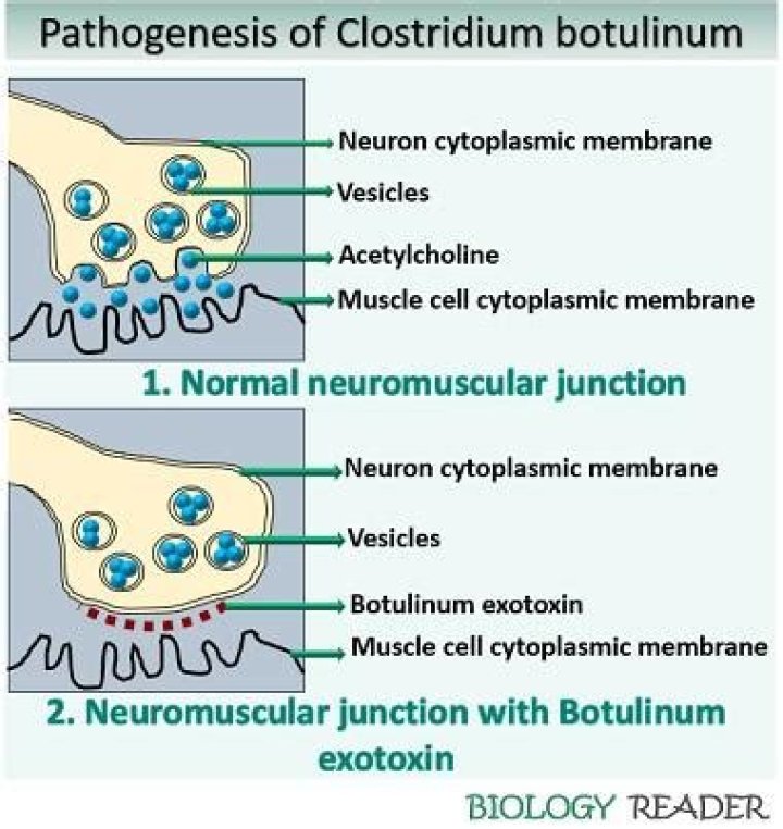 Why is botulinum produced?