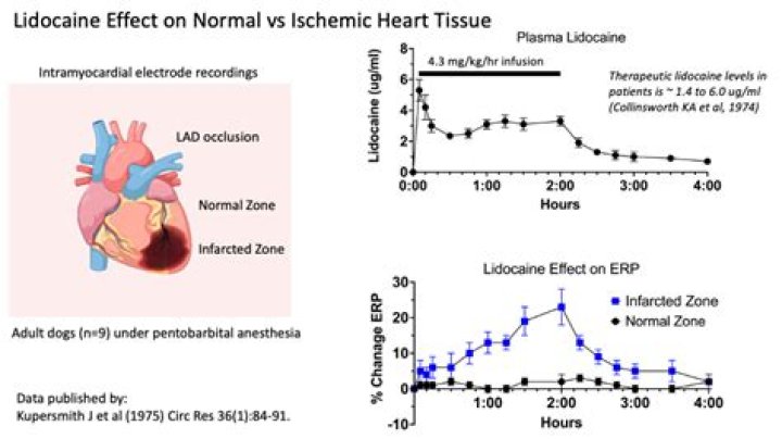 Why is lidocaine used for arrhythmias?