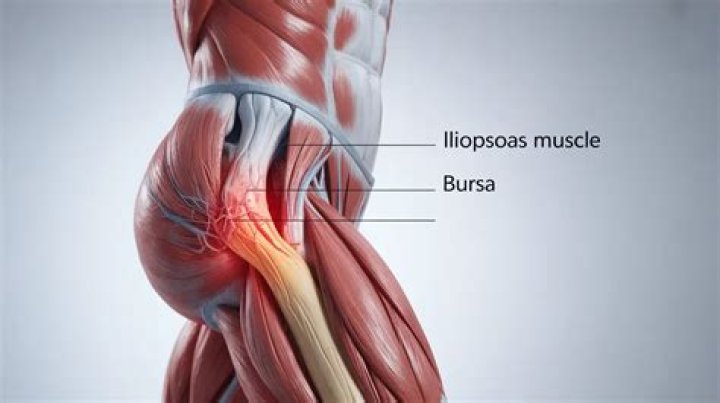 Why is my iliopsoas so tight?