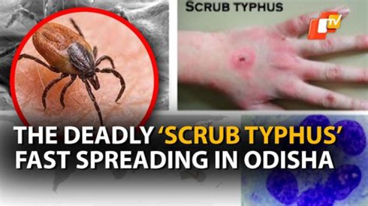 Why is typhus deadly?