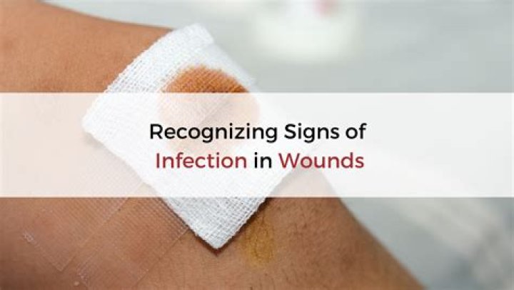 Would an infected wound hurt?