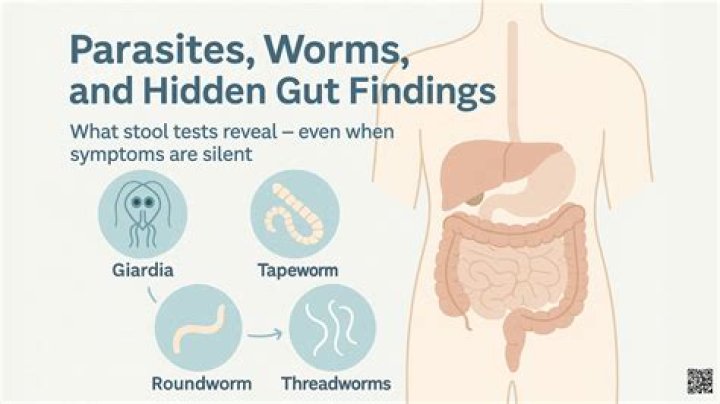 Would you see pinworms in stool?